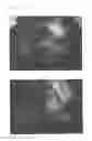 Fig. 10 - Method for treating alopecia with B-type natriuretic peptide