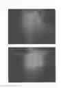 Fig. 11 - Method for treating alopecia with B-type natriuretic peptide