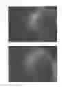 Fig. 12 - Method for treating alopecia with B-type natriuretic peptide
