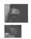 Fig. 13 - Method for treating alopecia with B-type natriuretic peptide