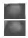 Fig. 15 - Method for treating alopecia with B-type natriuretic peptide