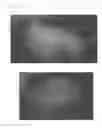 Fig. 17 - Method for treating alopecia with B-type natriuretic peptide
