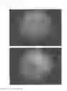 Fig. 20 - Method for treating alopecia with B-type natriuretic peptide