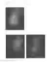 Fig. 24 - Method for treating alopecia with B-type natriuretic peptide
