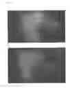 Fig. 26 - Method for treating alopecia with B-type natriuretic peptide
