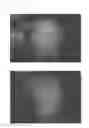 Fig. 27 - Method for treating alopecia with B-type natriuretic peptide