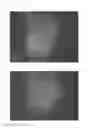 Fig. 30 - Method for treating alopecia with B-type natriuretic peptide