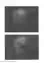Fig. 31 - Method for treating alopecia with B-type natriuretic peptide