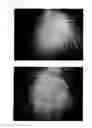 Fig. 40 - Method for treating alopecia with B-type natriuretic peptide
