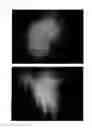 Fig. 43 - Method for treating alopecia with B-type natriuretic peptide