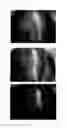 Fig. 53 - Method for treating alopecia with B-type natriuretic peptide