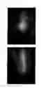 Fig. 54 - Method for treating alopecia with B-type natriuretic peptide