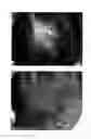 Fig. 56 - Method for treating alopecia with B-type natriuretic peptide