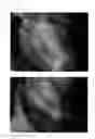 Fig. 58 - Method for treating alopecia with B-type natriuretic peptide