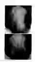 Fig. 59 - Method for treating alopecia with B-type natriuretic peptide