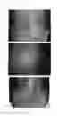 Fig. 60 - Method for treating alopecia with B-type natriuretic peptide