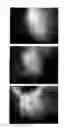 Fig. 61 - Method for treating alopecia with B-type natriuretic peptide