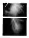 Fig. 63 - Method for treating alopecia with B-type natriuretic peptide