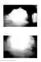 Fig. 02 - Use of CGRP antagonist compounds for treatment of psoriasis