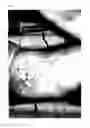 Fig. 07 - Use of CGRP antagonist compounds for treatment of psoriasis