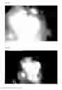 Fig. 08 - Use of CGRP antagonist compounds for treatment of psoriasis