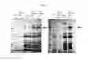 Fig. 08 - VACCINE AGAINST ACINETOBACTER BAUMANNII BASED ON CELLULAR COMPONENTS DEFICIENT IN LIPOPOLYSACCHARIDE