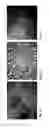 Fig. 02 - COMPOSITIONS, METHODS AND USES FOR THERMALLY STABLE HUMAN PAPILLOMAVIRUS FORMULATIONS