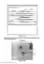 Fig. 02 - Lysosomal targeting of antigens employing nucleic acids encoding lysosomal membrane polypeptide/antigen chimeras