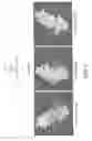 Fig. 05 - THYROID STIMULATING HORMONE COMPOSITIONS