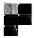 Fig. 06 - COMPOSITION FOR IMAGING ATHEROSCLEROSIS AND METHOD FOR DIAGNOSING ATHEROSCLEROSIS BY USING SAME
