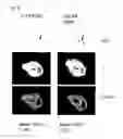 Fig. 10 - COMPOSITION FOR IMAGING ATHEROSCLEROSIS AND METHOD FOR DIAGNOSING ATHEROSCLEROSIS BY USING SAME