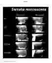 Fig. 12 - Compositions and methods for multipurpose disinfection and sterilization solutions