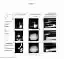 Fig. 02 - Injectable sterile aqueous formulation based on crosslinked hyaluronic acid and hydroxyapatite for aesthetic use