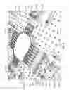 Fig. 05 - Tissue modification devices, systems, and methods