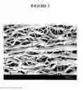 Fig. 04 - Articles including expanded polytetrafluoroethylene membranes with serpentine fibrils having a discontinuous fluoropolymer layer thereon