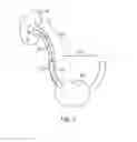 Fig. 05 - System and method for guided removal from an in vivo subject