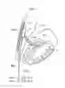 Fig. 02 - Heart help device, system, and method