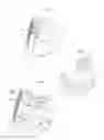 Fig. 04 - Heart help device, system, and method