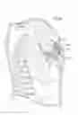 Fig. 42 - Heart help device, system, and method