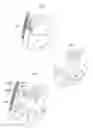 Fig. 04 - Heart help device, system and method