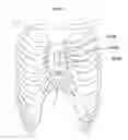 Fig. 23 - Heart help device, system and method