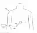 Fig. 27 - Heart help device, system and method