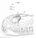 Fig. 45 - Heart help device, system and method