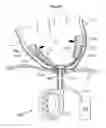 Fig. 49 - Heart help device, system and method