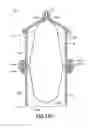 Fig. 101 - Bladder syringe fluid delivery system
