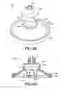 Fig. 102 - Bladder syringe fluid delivery system