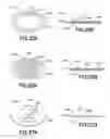 Fig. 27 - Bladder syringe fluid delivery system