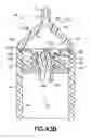 Fig. 37 - Bladder syringe fluid delivery system