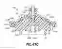 Fig. 44 - Bladder syringe fluid delivery system