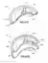 Fig. 46 - Bladder syringe fluid delivery system